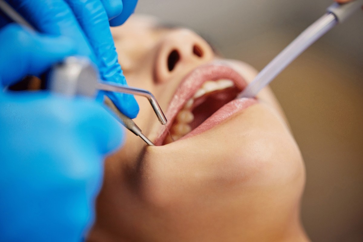 Gum-Disease