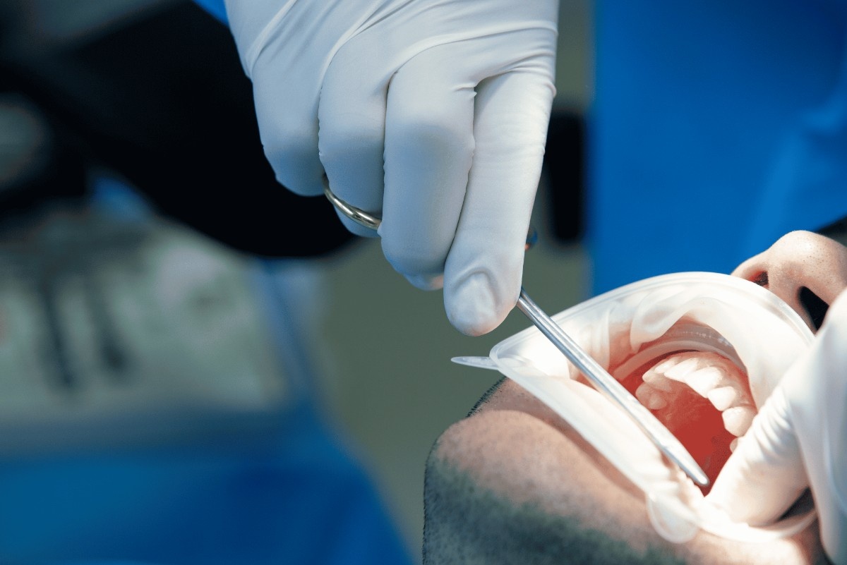 Oral-Surgery