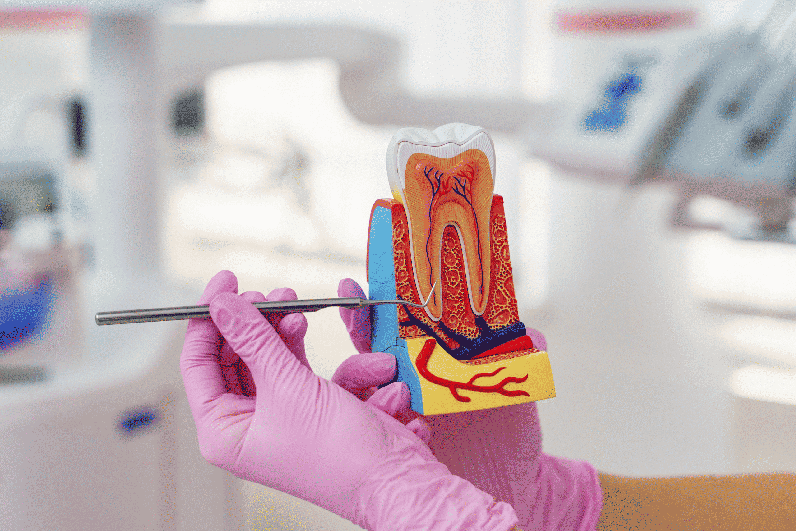 RootCanal