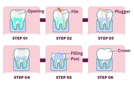 root-steps (1)